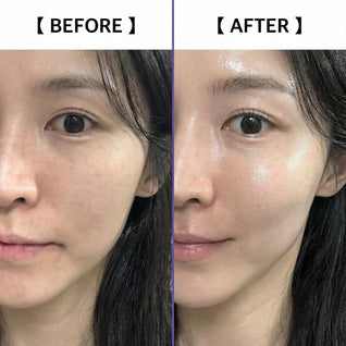 Hyaluronic PDRN Orb Serum