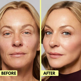 Retinal Renewal Shot