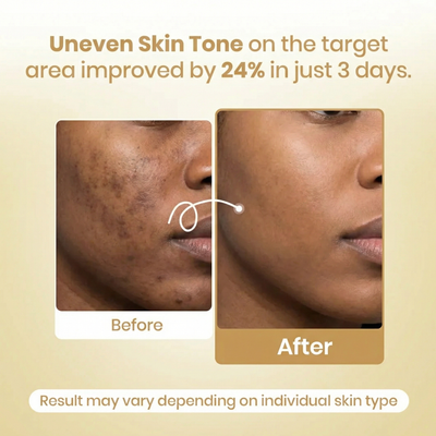 Kojic Acid Tumeric Night Wrapping Mask